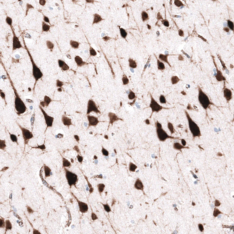 Immunohistochemistry (Formalin/PFA-fixed paraffin-embedded sections) - Anti-ELAVL2 Antibody [CL15329] (AB327162)