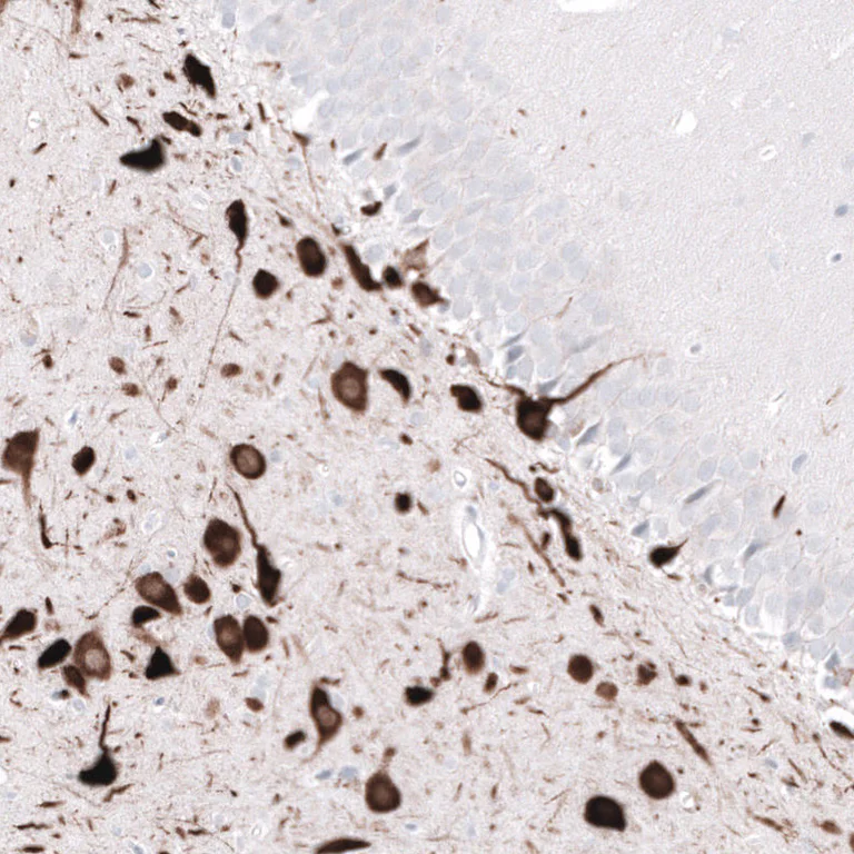 Immunohistochemistry (Formalin/PFA-fixed paraffin-embedded sections) - Anti-ELAVL2 Antibody [CL15329] (AB327162)