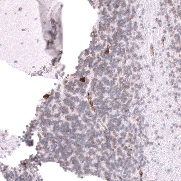 Immunohistochemistry (Formalin/PFA-fixed paraffin-embedded sections) - Anti-ELAVL2 Antibody [CL15329] (AB327162)