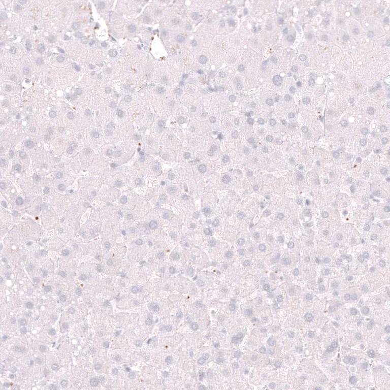 Immunohistochemistry (Formalin/PFA-fixed paraffin-embedded sections) - Anti-ELAVL2 Antibody [CL15329] (AB327162)