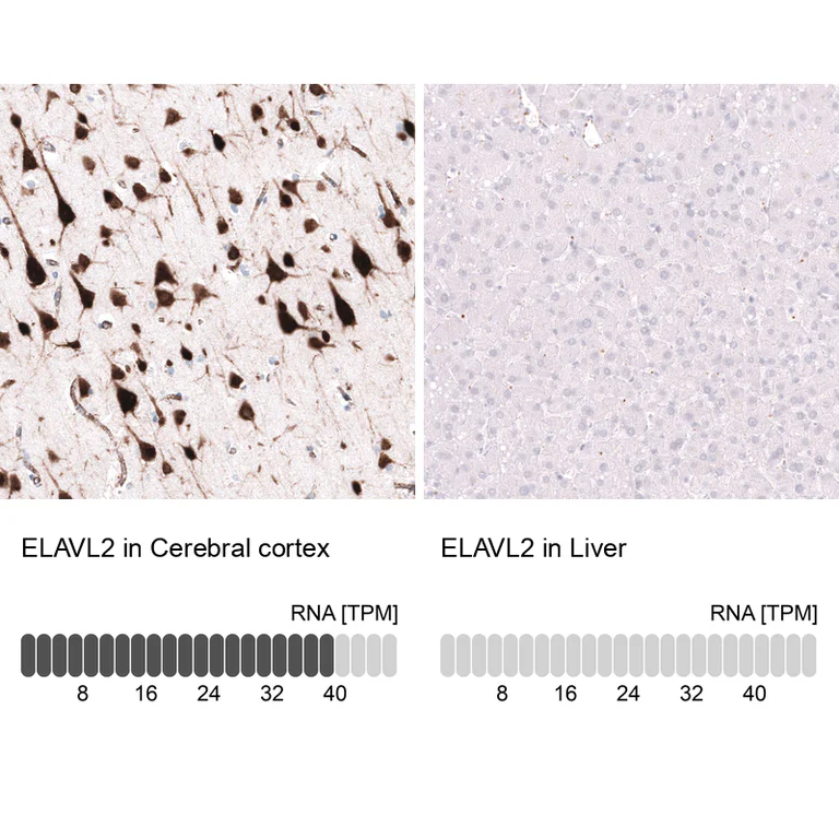 Immunohistochemistry (Formalin/PFA-fixed paraffin-embedded sections) - Anti-ELAVL2 Antibody [CL15329] (AB327162)