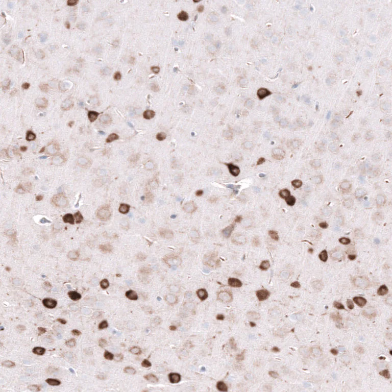Immunohistochemistry (Formalin/PFA-fixed paraffin-embedded sections) - Anti-ELAVL2 Antibody [CL15329] (AB327162)