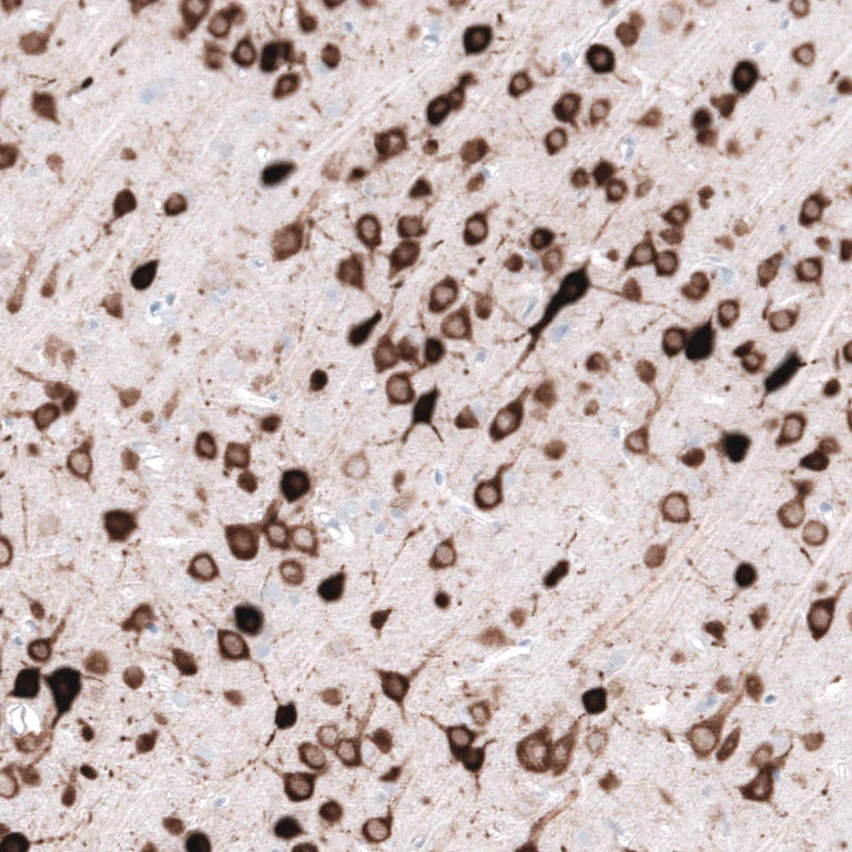 Immunohistochemistry (Formalin/PFA-fixed paraffin-embedded sections) - Anti-ELAVL2 Antibody [CL15329] (AB327162)