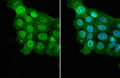 Immunocytochemistry/ Immunofluorescence - Anti-ELAVL2 antibody [HL1978] (AB308577)