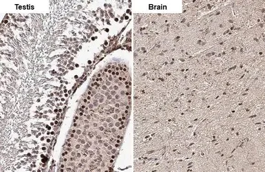 Immunohistochemistry paraffin embedded sections - Anti-ELAVL2 antibody [HL1978] (AB308577)