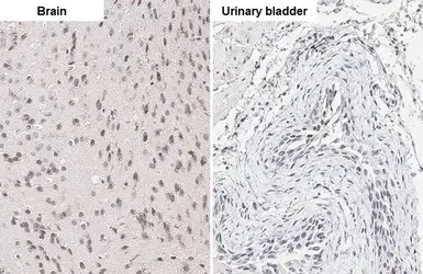Immunohistochemistry paraffin embedded sections - Anti-ELAVL2 antibody [HL1978] (AB308577)