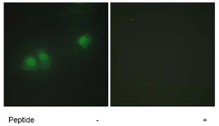 Immunocytochemistry/ Immunofluorescence - Anti-ELAVL2 + ELAVL4 antibody (AB72603), expandable thumbnail
