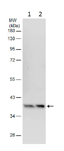 Western blot - Anti-elF2 alpha (phospho S52) antibody - N-terminal (AB227593)