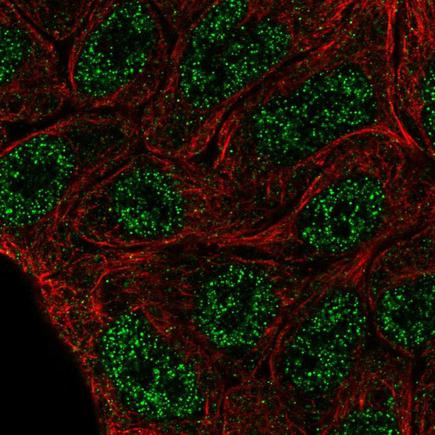 Immunocytochemistry/ Immunofluorescence - Anti-ELF5 antibody (AB222251), expandable thumbnail