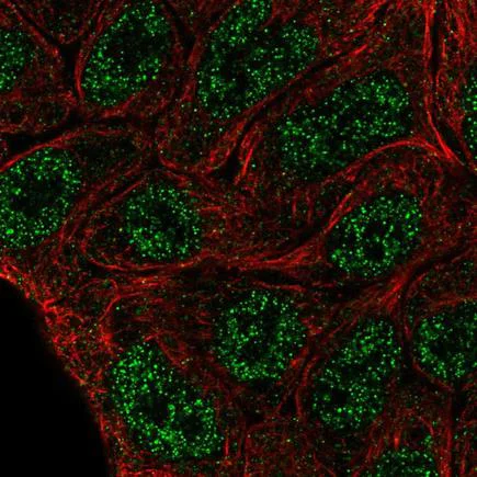 Immunocytochemistry/ Immunofluorescence - Anti-ELF5 antibody (AB222251)