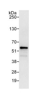 Immunoprecipitation - Anti-ELK1 antibody (AB125085)