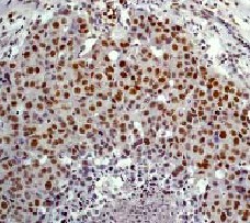 Immunohistochemistry (Formalin/PFA-fixed paraffin-embedded sections) - Anti-ELK1 antibody [E277] (AB32106)
