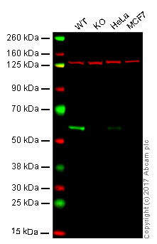 Western blot - Anti-ELK1 antibody [E277] (AB32106)