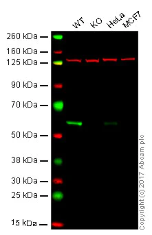 Western blot - Anti-ELK1 antibody [E277] (AB32106)