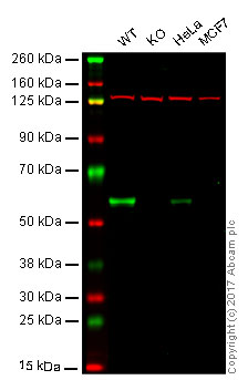 Western blot - Anti-ELK1 antibody [EPR1913(2)] - BSA and Azide free (AB250948), expandable thumbnail
