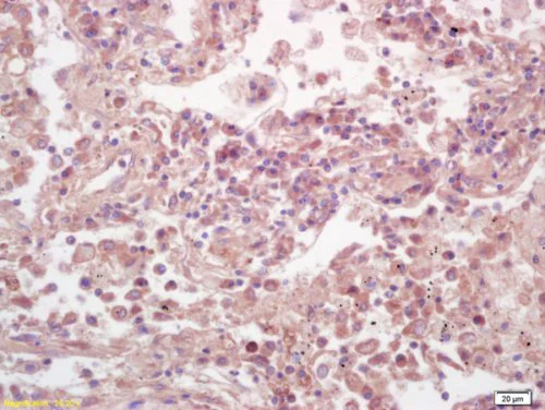 Immunohistochemistry (Formalin/PFA-fixed paraffin-embedded sections) - Anti-ELK1 (phospho S383) antibody (AB218133)