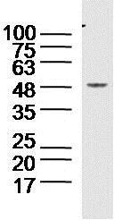 Western blot - Anti-ELK1 (phospho S383) antibody (AB218133)