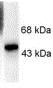 Western blot - Anti-ELK1 (phospho S383) antibody (AB34270)