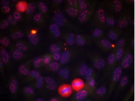 Immunocytochemistry/ Immunofluorescence - Anti-ELK1 (phospho T417) antibody (AB194795)