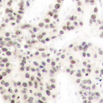 Immunohistochemistry (Formalin/PFA-fixed paraffin-embedded sections) - Anti-ELK1 (phospho T417) antibody (AB194795)