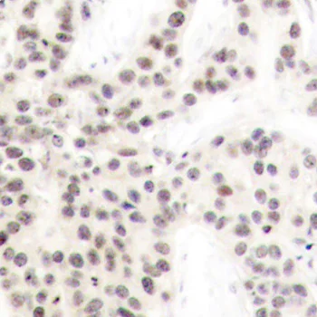 Immunohistochemistry (Formalin/PFA-fixed paraffin-embedded sections) - Anti-ELK1 (phospho T417) antibody (AB194795)