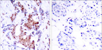 Immunohistochemistry (Formalin/PFA-fixed paraffin-embedded sections) - Anti-ELK1 (phospho T417) antibody (AB28817)