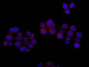 Immunocytochemistry/ Immunofluorescence - Anti-ELKS antibody [EPR13777] - BSA and Azide free (AB250209)