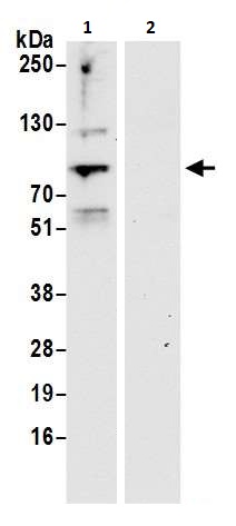 Immunoprecipitation - Anti-ELL antibody (AB264218)