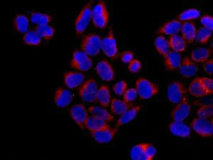Immunocytochemistry/ Immunofluorescence - Anti-Ellis van Creveld syndrome antibody [EPR10408] (AB171952)