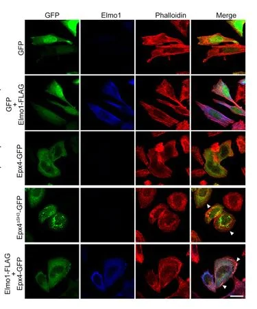 Immunocytochemistry/ Immunofluorescence - Anti-ELMO1 antibody [EPR12919] (AB174298)