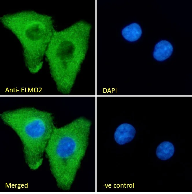 Immunocytochemistry/ Immunofluorescence - Anti-ELMO2 antibody (AB2240)