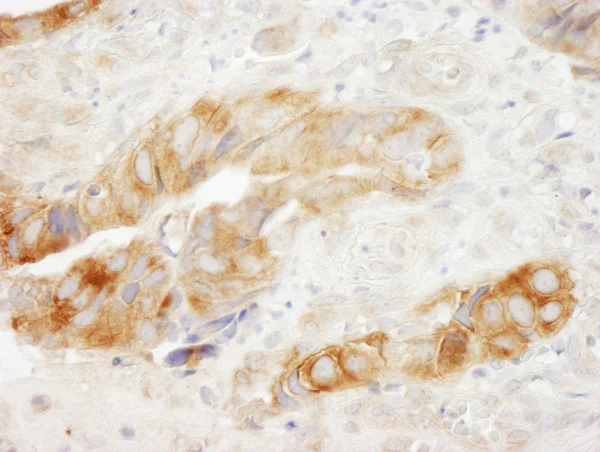 Immunohistochemistry (Formalin/PFA-fixed paraffin-embedded sections) - Anti-Elongation factor 1-gamma antibody (AB72368)