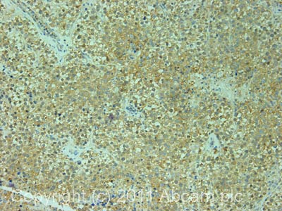 Immunohistochemistry (Formalin/PFA-fixed paraffin-embedded sections) - Anti-Elongation factor 1-gamma antibody (AB72368)