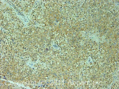 Immunohistochemistry (Formalin/PFA-fixed paraffin-embedded sections) - Anti-Elongation factor 1-gamma antibody (AB72368)