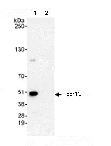 Immunoprecipitation - Anti-Elongation factor 1-gamma antibody (AB72368)