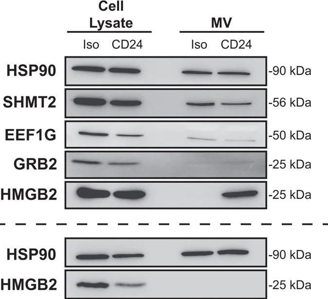 Western blot - Anti-Elongation factor 1-gamma antibody (AB72368)