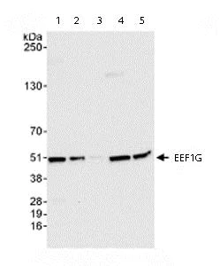 Western blot - Anti-Elongation factor 1-gamma antibody (AB72368)