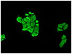 Immunocytochemistry/ Immunofluorescence - Anti-Elongation factor 1-gamma antibody [EPR7200] (AB124994)