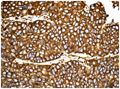 Immunohistochemistry (Formalin/PFA-fixed paraffin-embedded sections) - Anti-Elongation factor 1-gamma antibody [EPR7200] (AB124994), expandable thumbnail