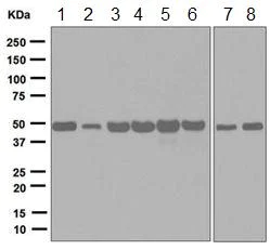 Western blot - Anti-Elongation factor 1-gamma antibody [EPR7200] (AB124994)