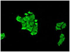 Immunocytochemistry/ Immunofluorescence - Anti-Elongation factor 1-gamma antibody [EPR7200] - BSA and Azide free (AB248088)
