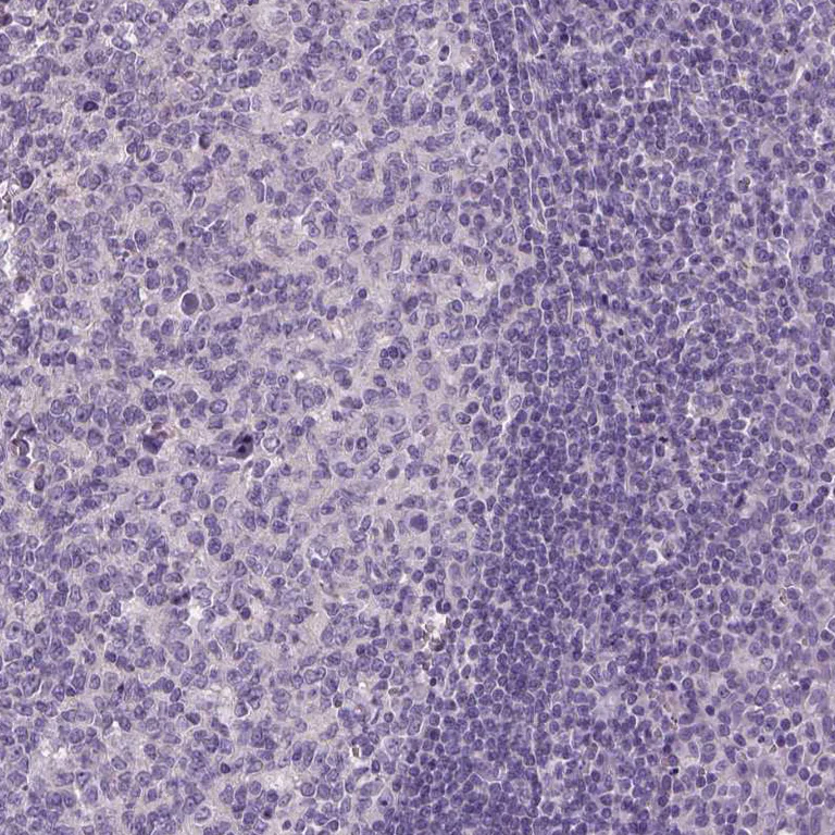 Immunohistochemistry (Formalin/PFA-fixed paraffin-embedded sections) - Anti-Elongation of very long chain fatty acids protein 3 antibody (AB253016)