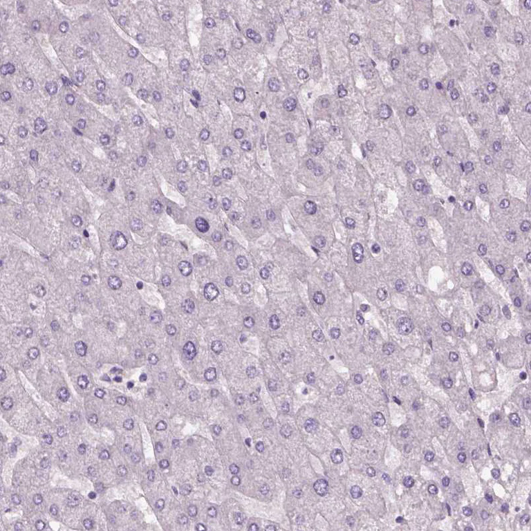 Immunohistochemistry (Formalin/PFA-fixed paraffin-embedded sections) - Anti-Elongation of very long chain fatty acids protein 3 antibody (AB253016)