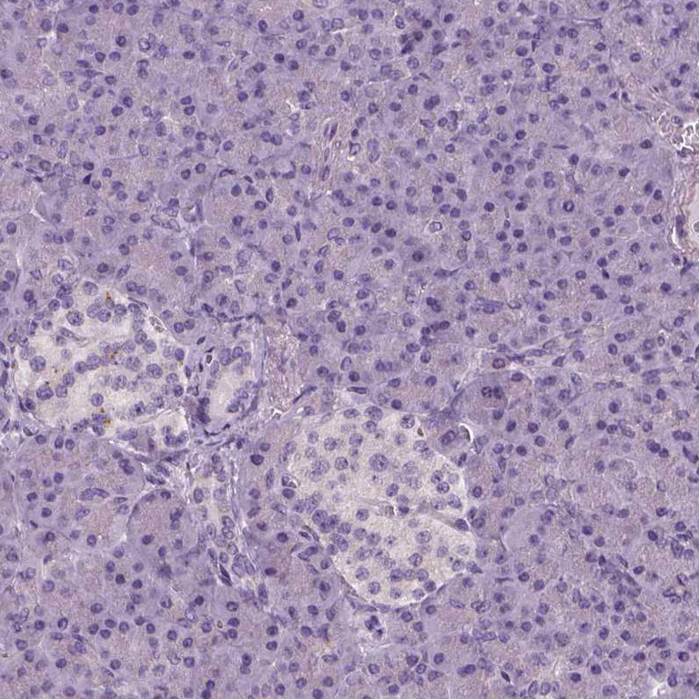 Immunohistochemistry (Formalin/PFA-fixed paraffin-embedded sections) - Anti-Elongation of very long chain fatty acids protein 3 antibody (AB253016)