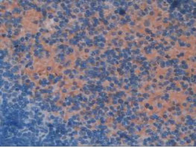 Immunohistochemistry (Formalin/PFA-fixed paraffin-embedded sections) - Anti-Elongin A antibody (AB231586)