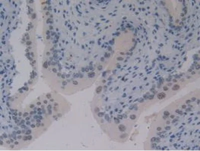 Immunohistochemistry (Formalin/PFA-fixed paraffin-embedded sections) - Anti-Elongin A antibody (AB231586)
