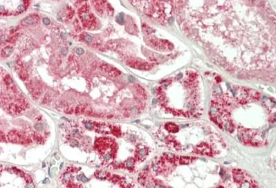 Immunohistochemistry (Formalin/PFA-fixed paraffin-embedded sections) - Anti-ELOVL1/SSC1 antibody (AB230634)
