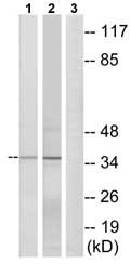 Western blot - Anti-ELOVL1/SSC1 antibody (AB74941)