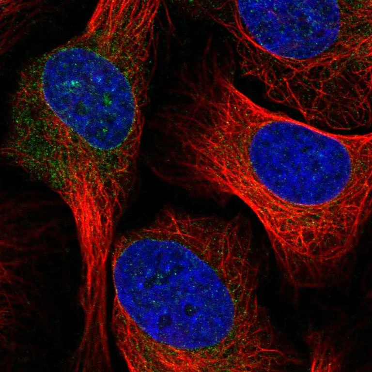 Immunocytochemistry/ Immunofluorescence - Anti-ELOVL1/SSC1 antibody - C-terminal (AB204489)