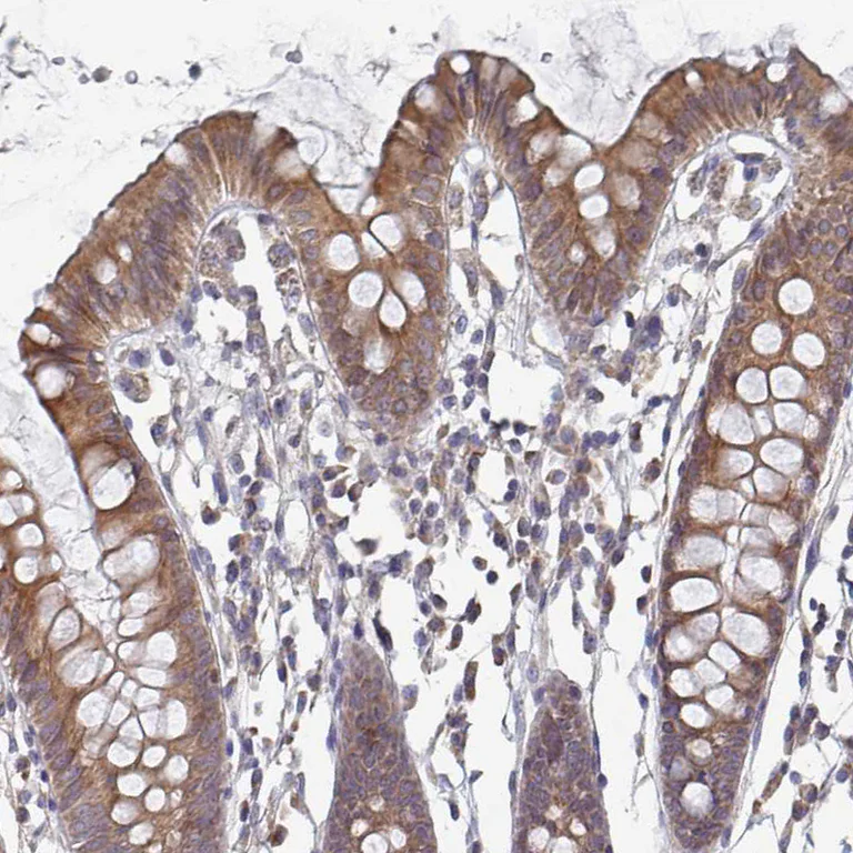 Immunohistochemistry (Formalin/PFA-fixed paraffin-embedded sections) - Anti-ELOVL1/SSC1 antibody - C-terminal (AB204489)
